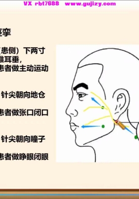 【九一针法】三天网络直播视频课三集💰8