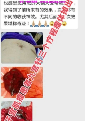 【徐熠筱】徐氏九宫针(多种妇科、三高、康复及疑难杂症)临床技术精品推广班2天课程💰5