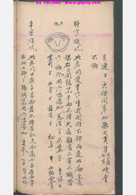 《民间喉舌方抄本》💰5